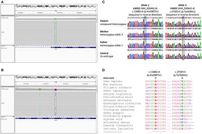 Case Report and Review of the Literature: A New and a Recurrent Variant in the VARS2 Gene Are Associated With Isolated Lethal Hypertrophic Cardiomyopathy, Hyperlactatemia, and Pulmonary Hypertension in Early Infancy